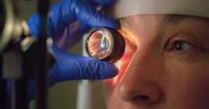 תפקידו של רופא עיניים בניתוחי קטרקט